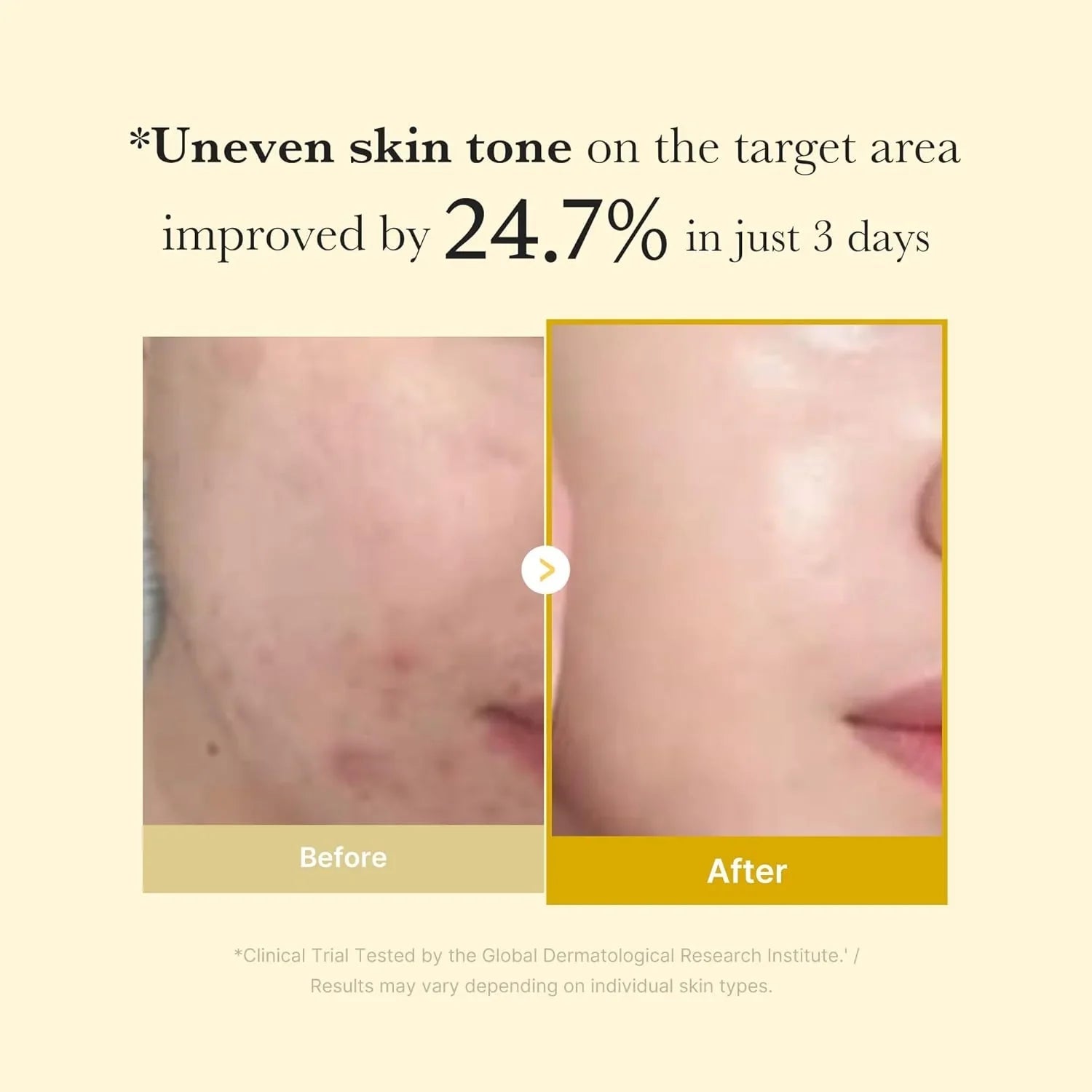 Medicube Kojic Acid Turmeric Night Wrapping Mask 75ml - Zayluxe Care