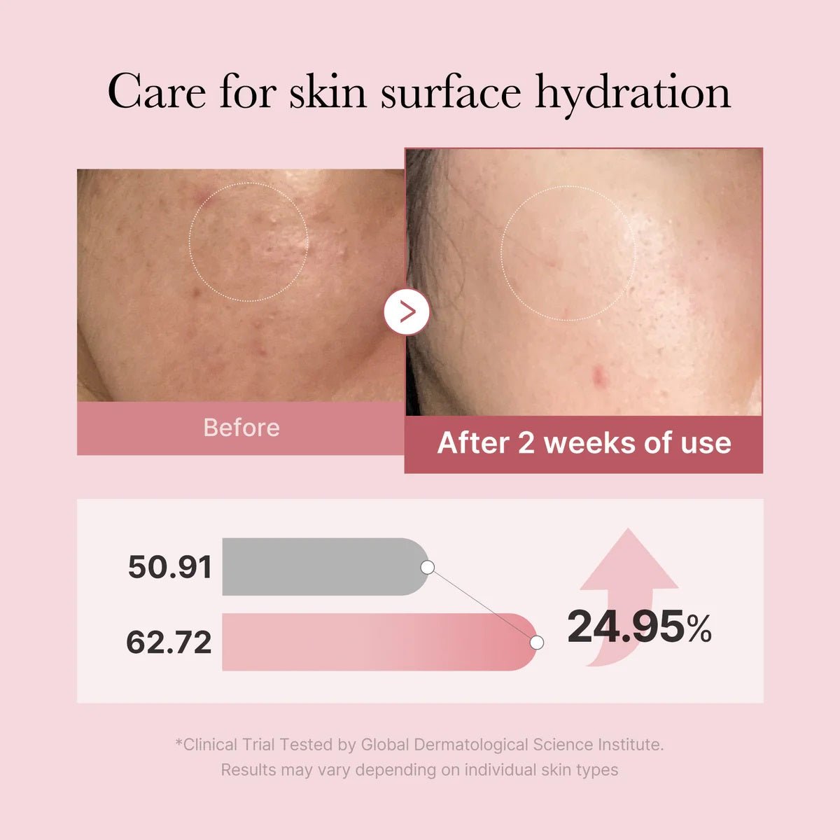 Medicube PDRN Pink Glutathione Serum Mist 100ml - Zayluxe Care