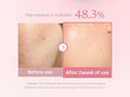 Medicube PDRN Pink Niacinamide Milky Toner 150ml - Zayluxe Care