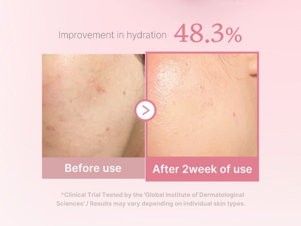 Medicube PDRN Pink Niacinamide Milky Toner 150ml - Zayluxe Care