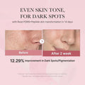 Medicube PDRN Pink Niacinamide Milky Toner 150ml - Zayluxe Care
