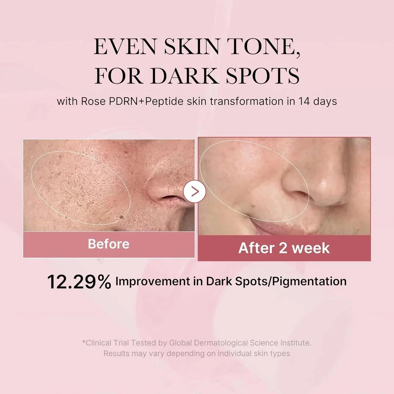 Medicube PDRN Pink Niacinamide Milky Toner 150ml - Zayluxe Care