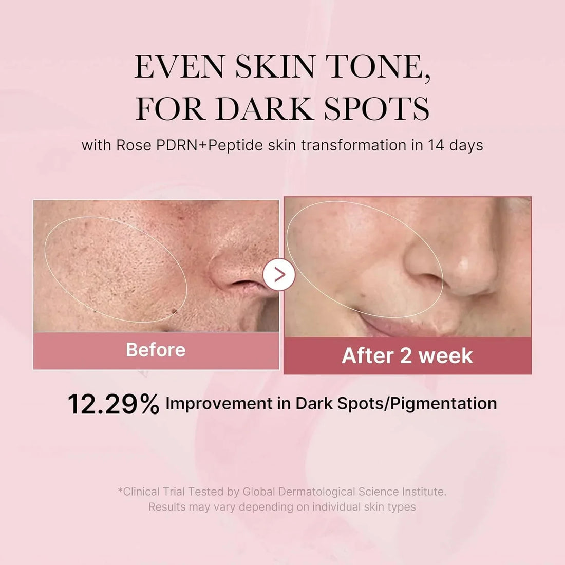 Medicube PDRN Pink Niacinamide Milky Toner 150ml