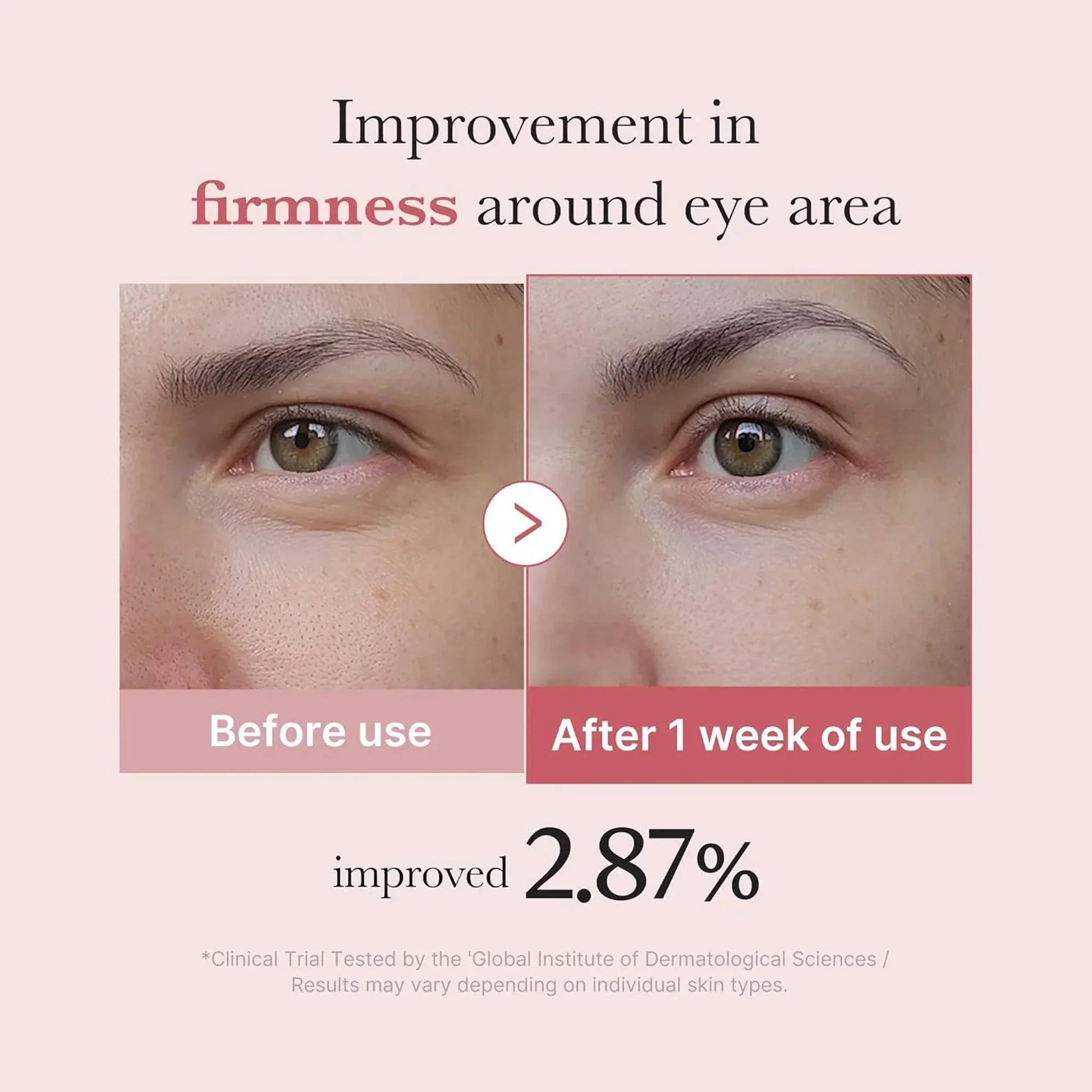 Medicube PDRN Pink Peptide Eye Cream 30ml - 30ml - Zayluxe Care