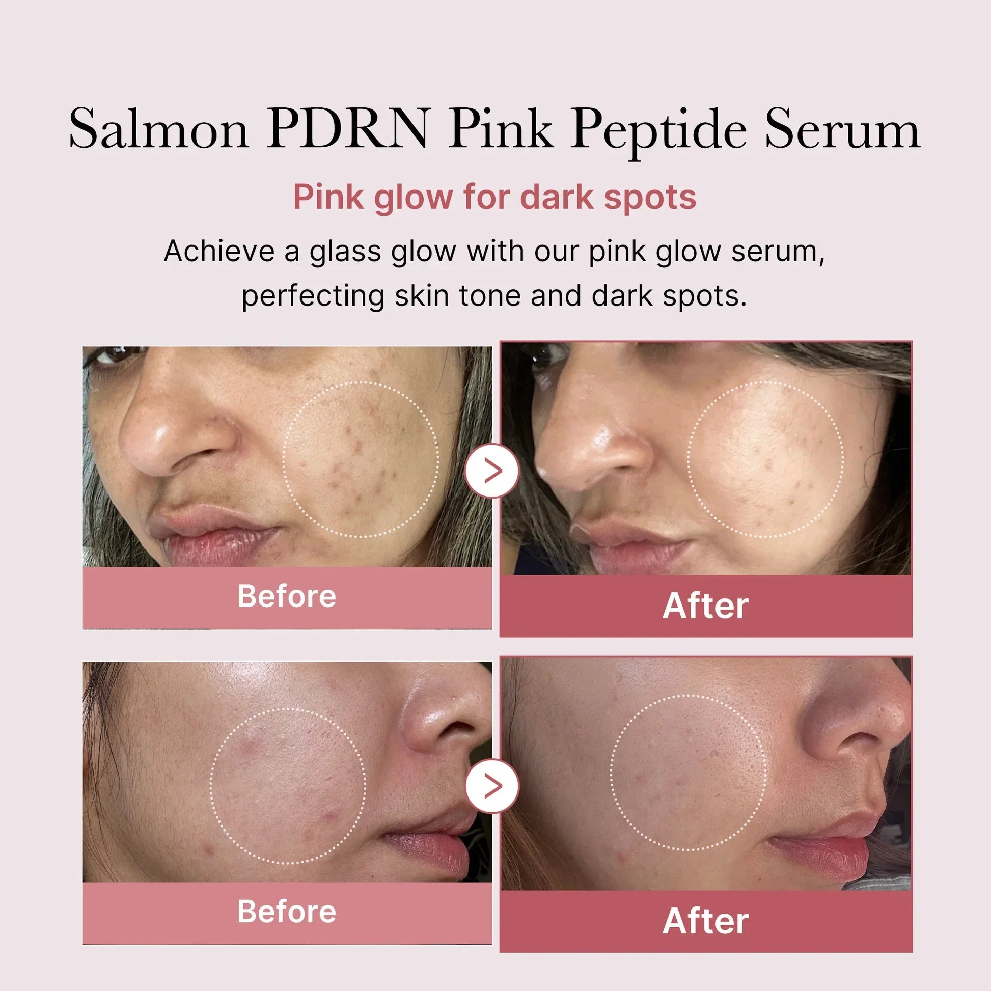 Medicube PDRN Pink Peptide Serum 30ml - Zayluxe Care