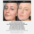 Medicube Red Acne Succinic Acid Peel | Peeling Serum 40g - Zayluxe Care