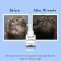 WishCare Hair Growth Serum Concentrate - Zayluxe Care