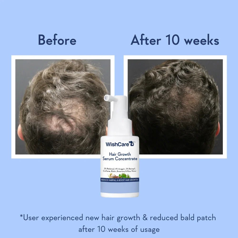 WishCare Hair Growth Serum Concentrate - Zayluxe Care