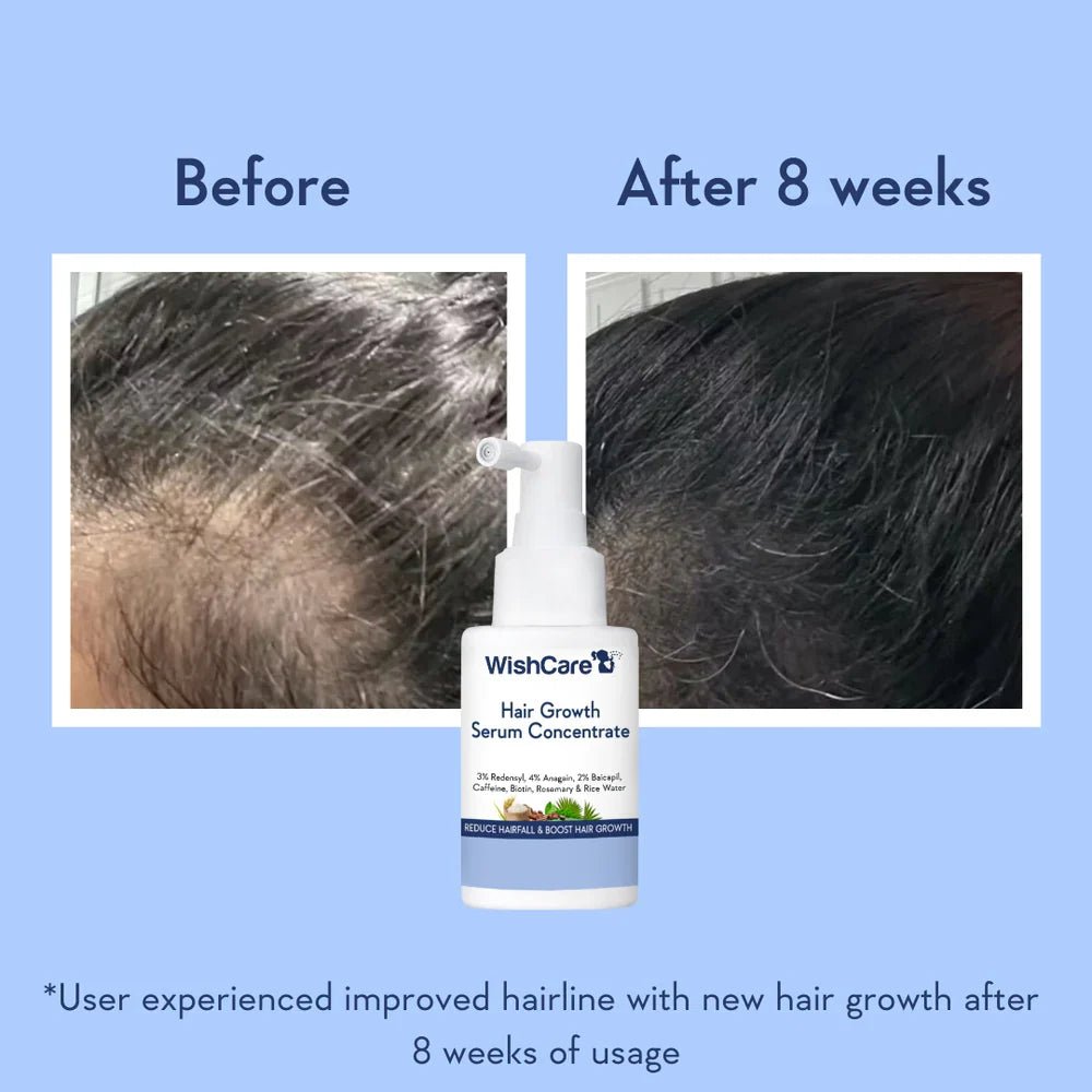 WishCare Hair Growth Serum Concentrate - Zayluxe Care